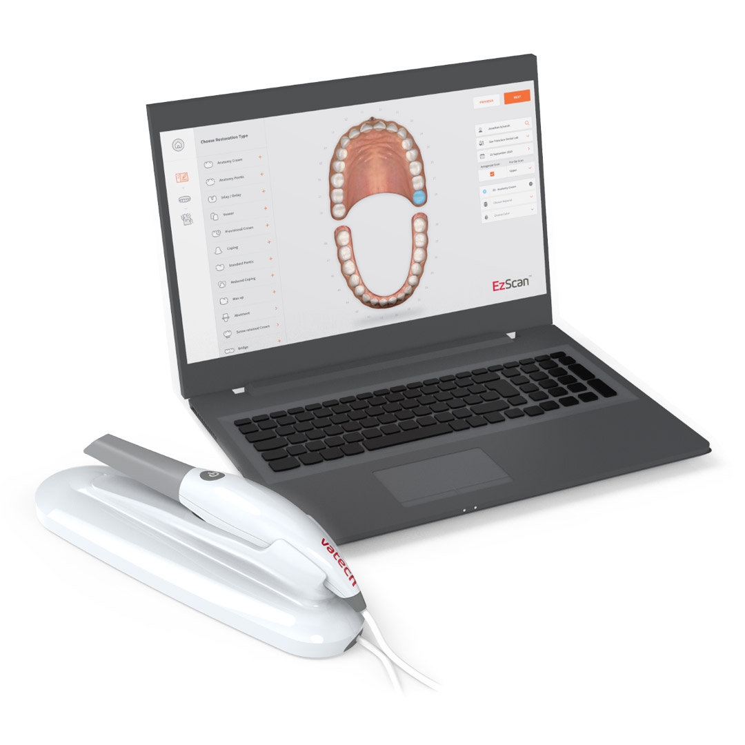 vatech-ezscan-3d-digital-intraoral-scanner-with-laptop-1653276186